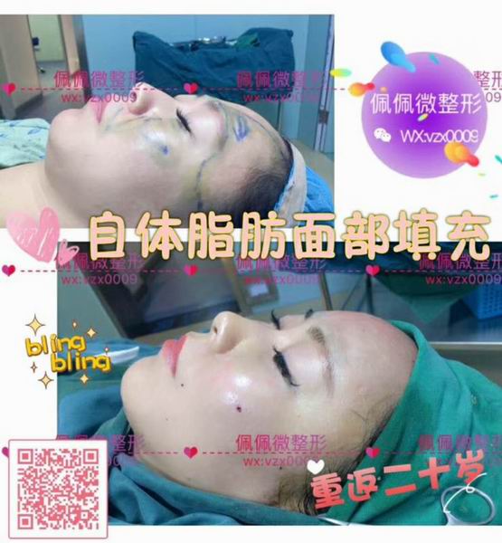 上海网红整形哪家好|上海哪家网红整形专业