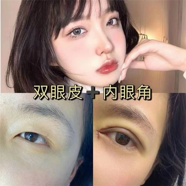 上海网红整形