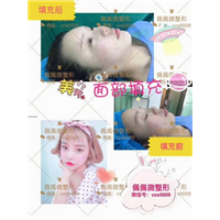 上海网红整形|上海网红修复整形
