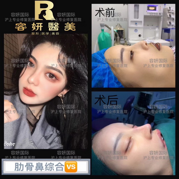 上海高级脸打造整形 