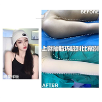 上海专业网红脸打造