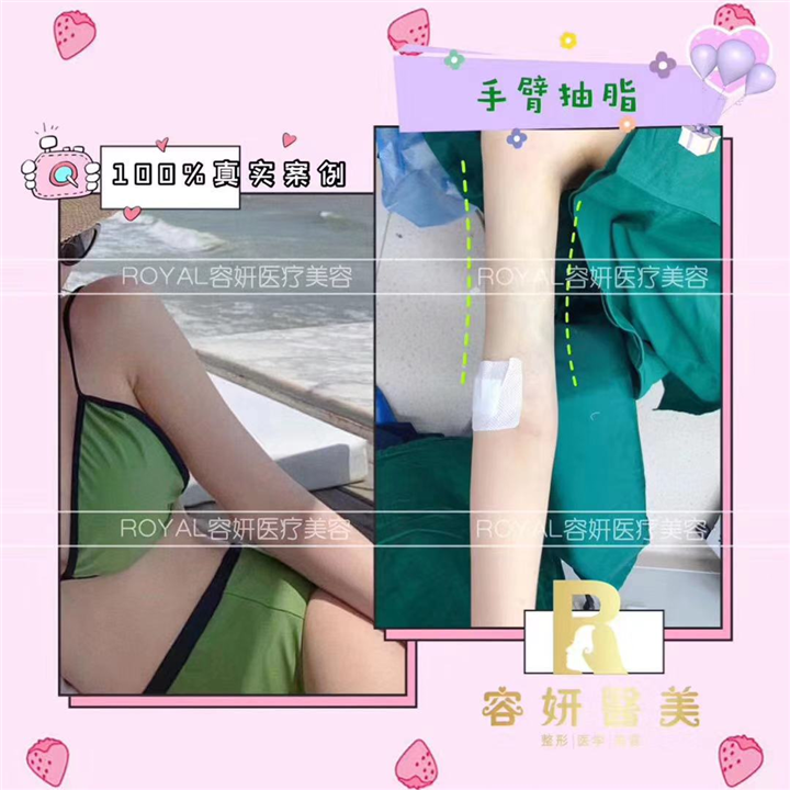 上海网红整形|上海佩佩医疗整形