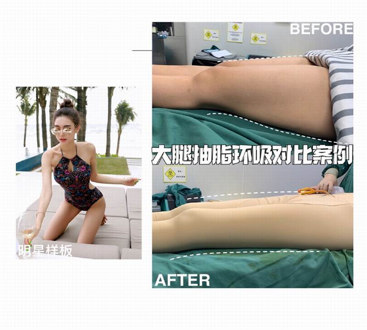 上海专业网红脸打造