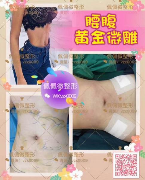 上海**专业的修复整形