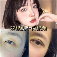 上海网红整形