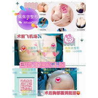 上海网红修复整形哪家好