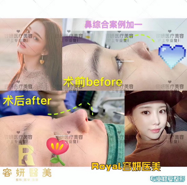 上海眼综合整形 