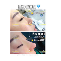 上海高级脸打造整形 