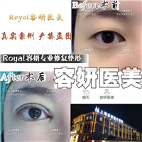 上海眼综合哪家专业 