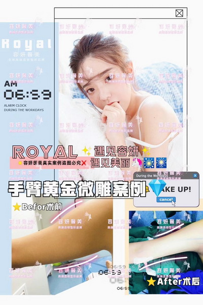 上海鼻综合整形 