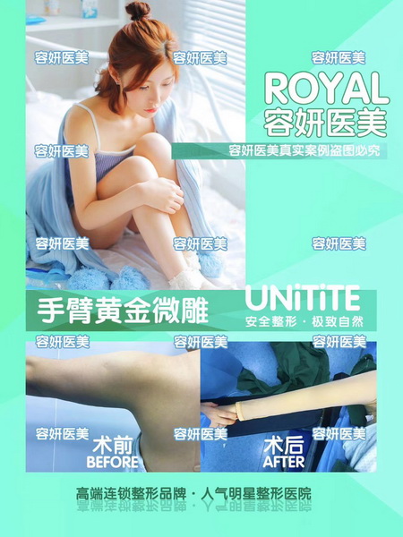 上海鼻综合整形 