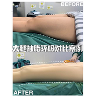 上海正规人气医美整形