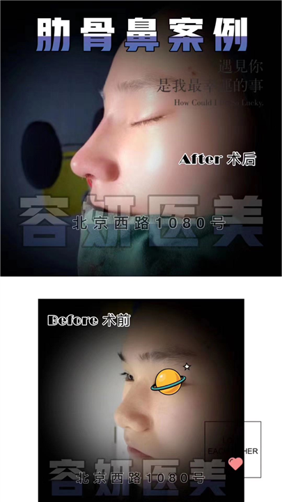 上海鼻综合整形哪家好 