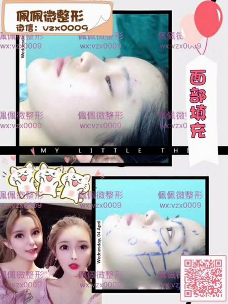 上海网红修复整形|上海网红整形哪家好