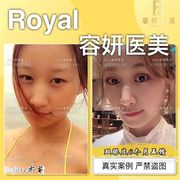 上海眼综合哪家专业 