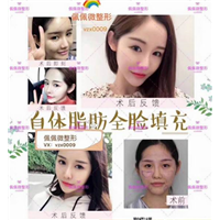 上海网红修复整形|上海网红整形哪家好