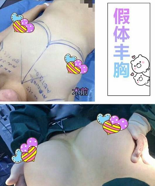 上海专业网红整形修复