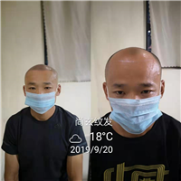 济南客户纹发前后