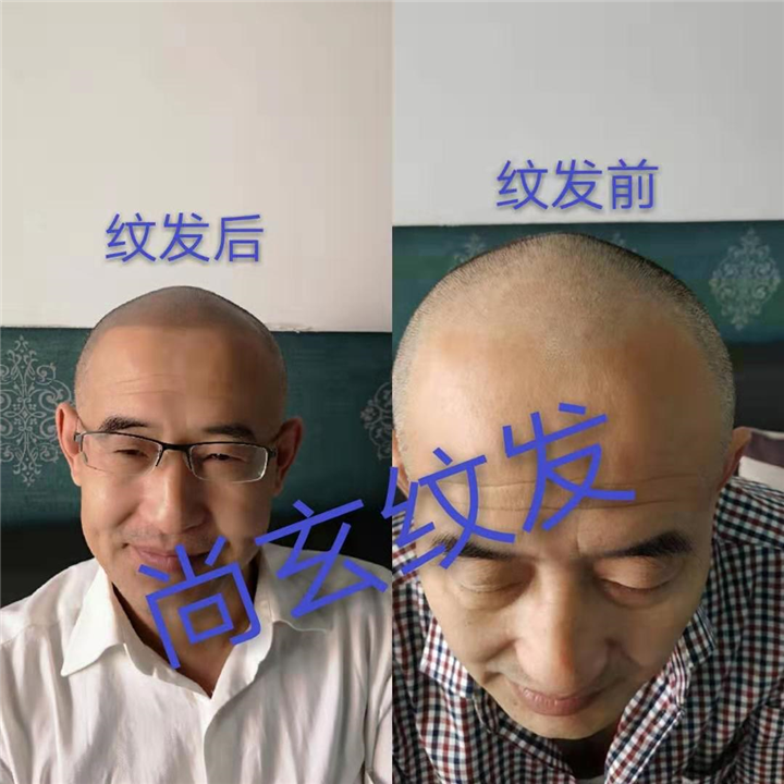 青岛客户纹发前后