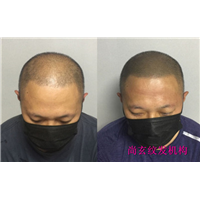 青岛纹发、纹发哪家好 