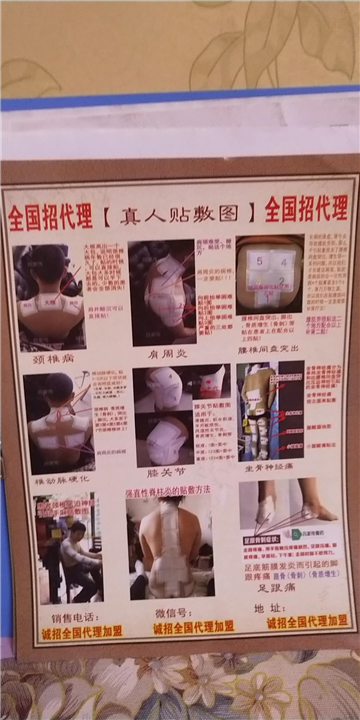 宁夏骨关节类风湿性膏药 