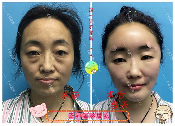 沈阳眼综合整形｜沈阳网红整形医院