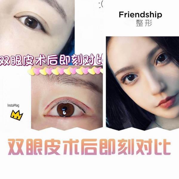 沈阳做双眼皮哪家好｜沈阳鼻部整形哪家好