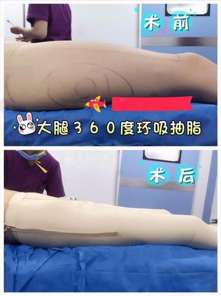 沈阳网红整形医院｜沈阳鼻综合整形