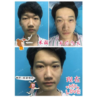 沈阳网红整形医院｜沈阳鼻综合整形