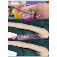 沈阳网红整形医院｜沈阳鼻综合整形