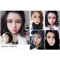 沈阳眼综合整形｜沈阳网红整形医院