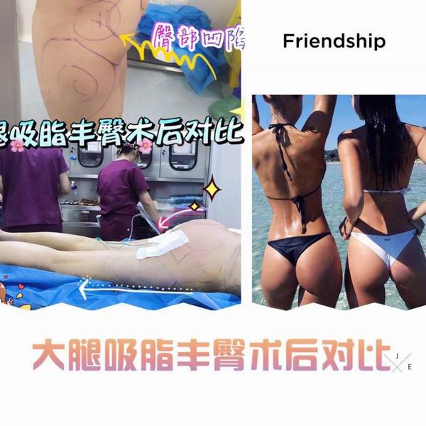 沈阳鼻综合整形｜沈阳做双眼皮哪家好