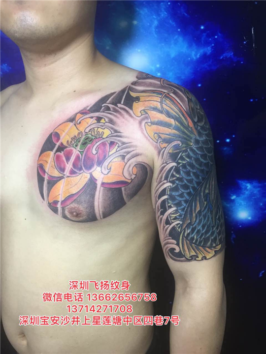 深圳洗纹身06