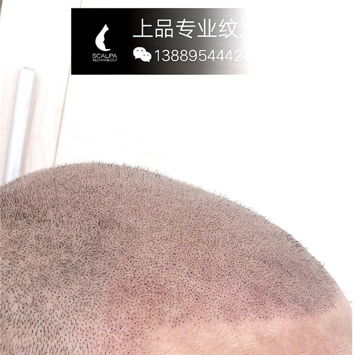 大连纹发 