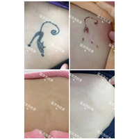 洗眉洗眼线东莞洗纹身