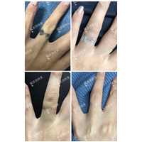 深圳附近洗纹身找哪家