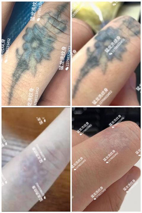 洗眉洗眼线罗湖洗纹身