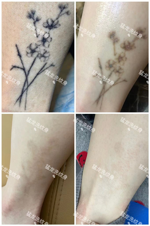 洗眉洗眼线广州洗纹身
