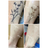 洗眉洗眼线广州洗纹身