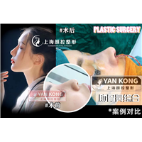 上海肋骨鼻整形