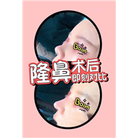 颜控鼻综合整形