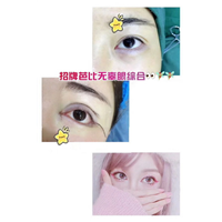 上海眼综合整形|上海吸脂瘦身