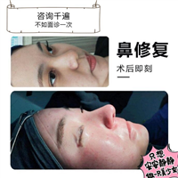 颜控鼻综合整形