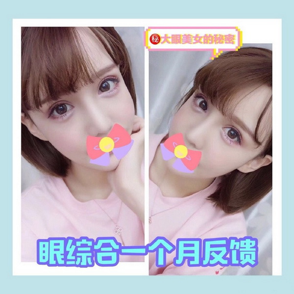 上海网红常去的整形|上海眼综合整形