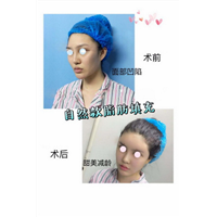 上海人气网红整形|上海鼻综合整形