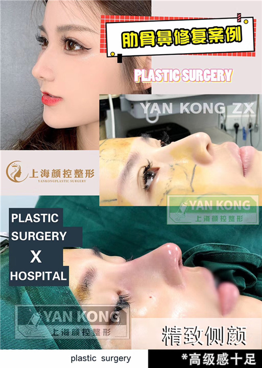 上海专业鼻综合专家