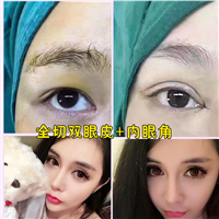 上海眼综合整形|上海吸脂瘦身