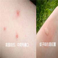 白云区跳蚤防治哪里好
