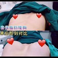 案例展示