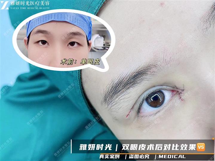 案例展示